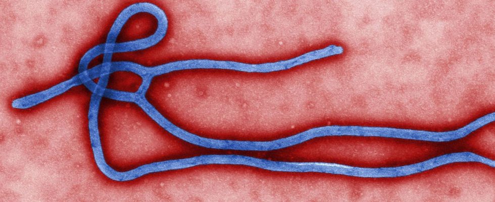 Sestra se v Texasu od mrtvého nakazila ebolou 1