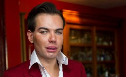 Na operace dal 170 tisíc. Chce vypadat jako panenka? 2