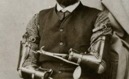 Protézy v minulosti, kvůli kterým pacienti trpěli 10