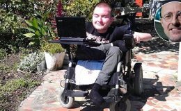 Přelom v medicíně? Muž podstoupí transplantaci hlavy 4