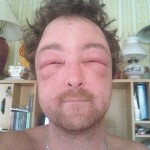 Alergie na moderní techniku? I takto vypadají nejdivnější diagnózy 10