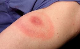 Nejhorší bolesti, které může člověk zažít: 7