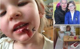 Ocelové dívka: necítí únavu, hlad ani bolest 40