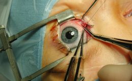 Mít oči na míru dnes není nemožné, stačí si jen vybrat metodu 10