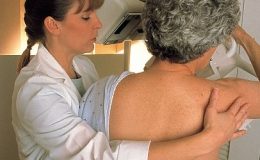 Mýty a fakta o mamografii: Je škodlivá a bolestivá? 1