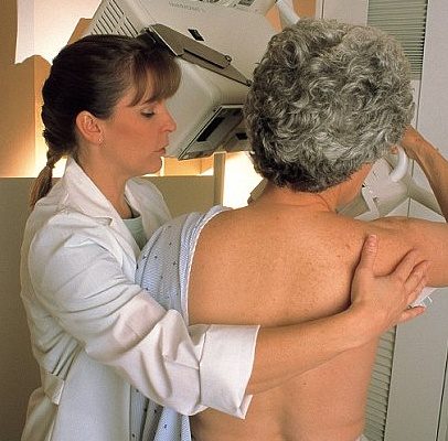 Mýty a fakta o mamografii: Je škodlivá a bolestivá? 1
