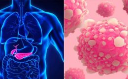 Rakovinu slinivky by mohl léčit upravený virus chřipky 7