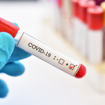 Jaký je rozdíl mezi rychlým testem na covid-19 a testy PCR? 11