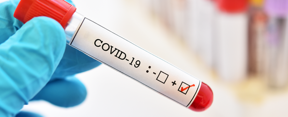 Testy na covid-19 od Celtrion Diatrust 1