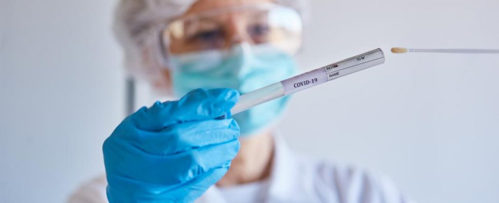Jak se liší protilátkové testy na covid-19 od diagnostických testů 1