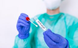 Testování na covid-19 a testy PCR 10