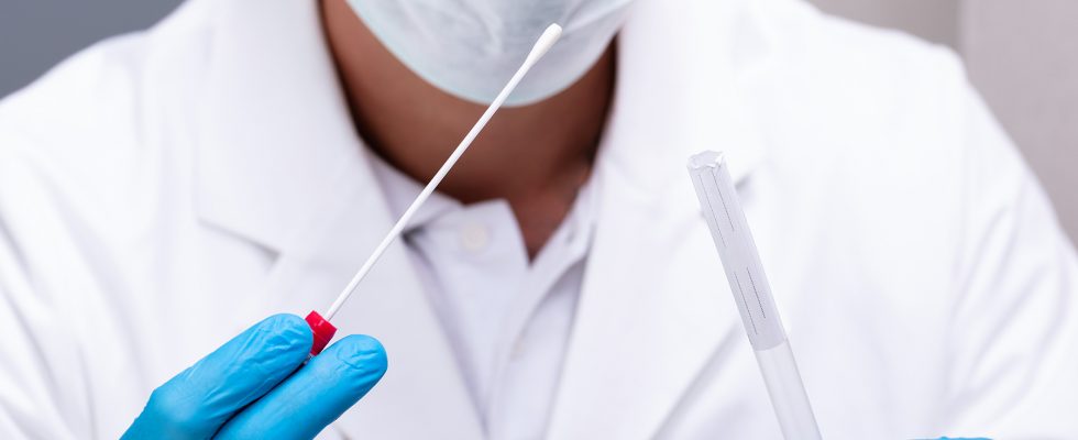 Testy z kožních stěrů mohou představovat budoucnost testů na covid-19 1