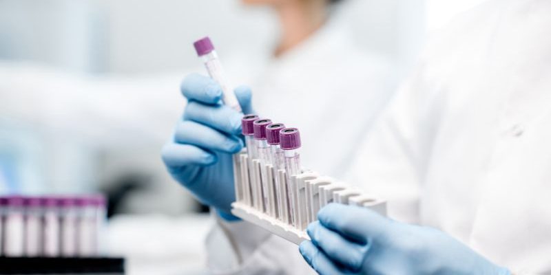 Diagnostika covid-19: srovnání testů ze slin a výtěrů z krku 1