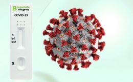 Rychlý test na COVID-19 IgM/IgG od Biopanda 2