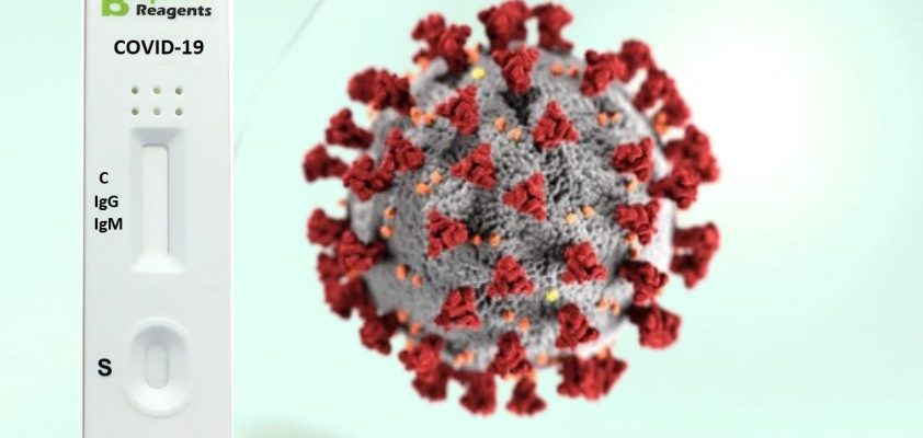Rychlý test na COVID-19 IgM/IgG od Biopanda 1