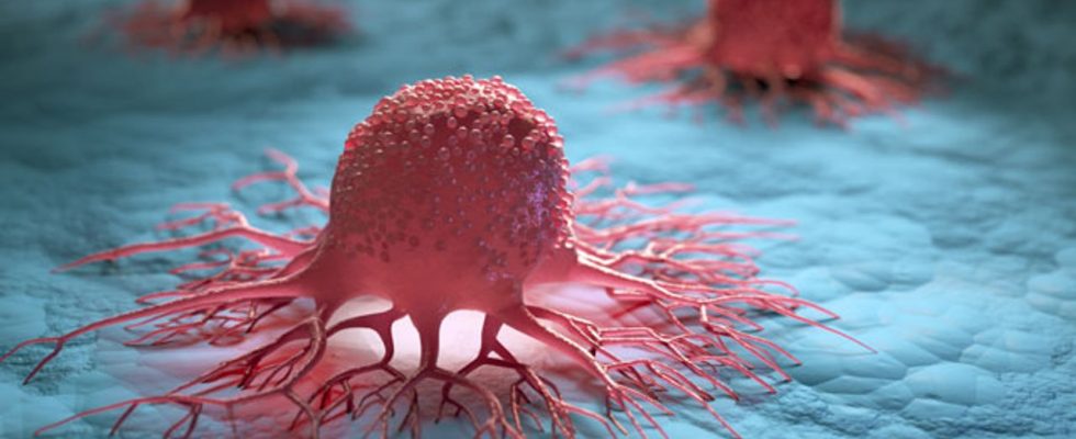 Sady imunitních buněk Goldilocks způsobují dramatické zmenšování nádorů 1
